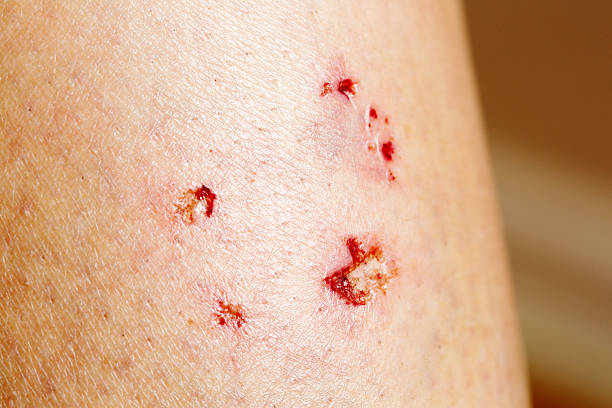 How Much is My Dog Bite Case Worth?