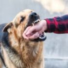 Is it worth suing for a dog bite?